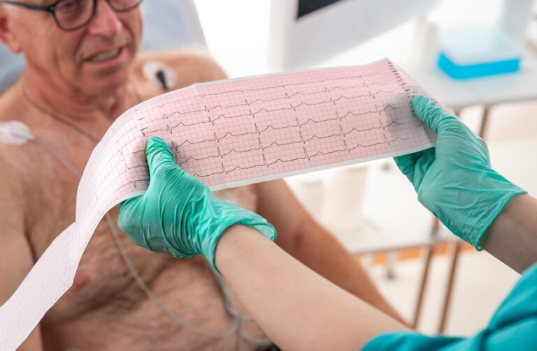 Ecg,Showing,A,Bundle,Branch,Block